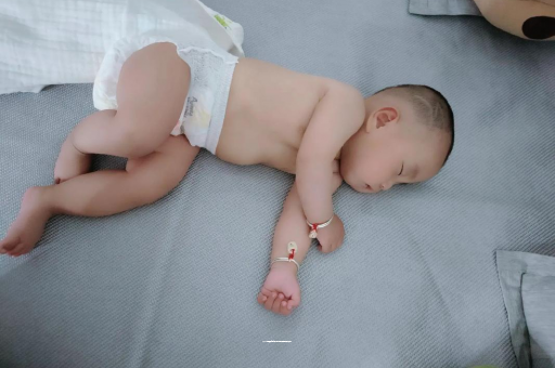 景德镇六个月宝宝眼睛散光